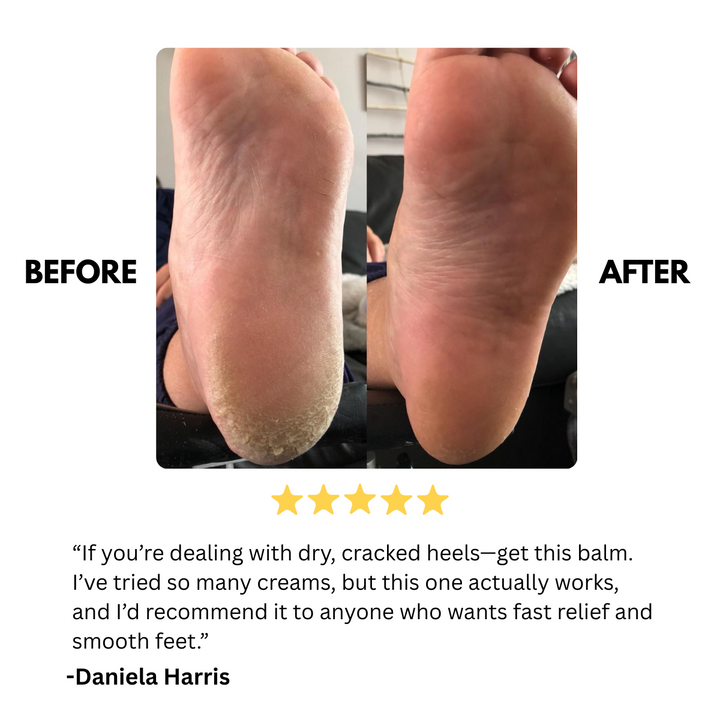 crack repair & deep moisturizing foot balm