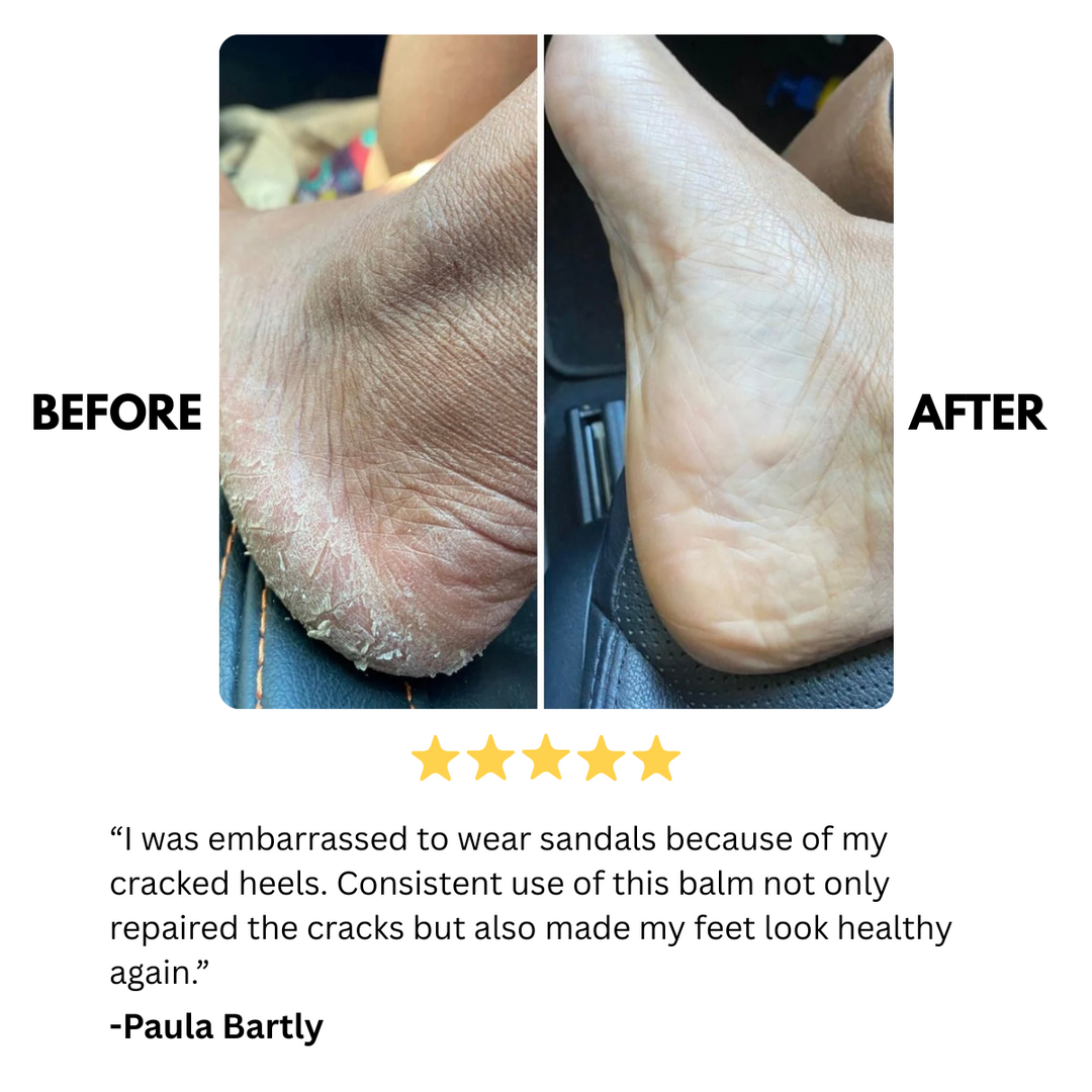 crack repair & deep moisturizing foot balm